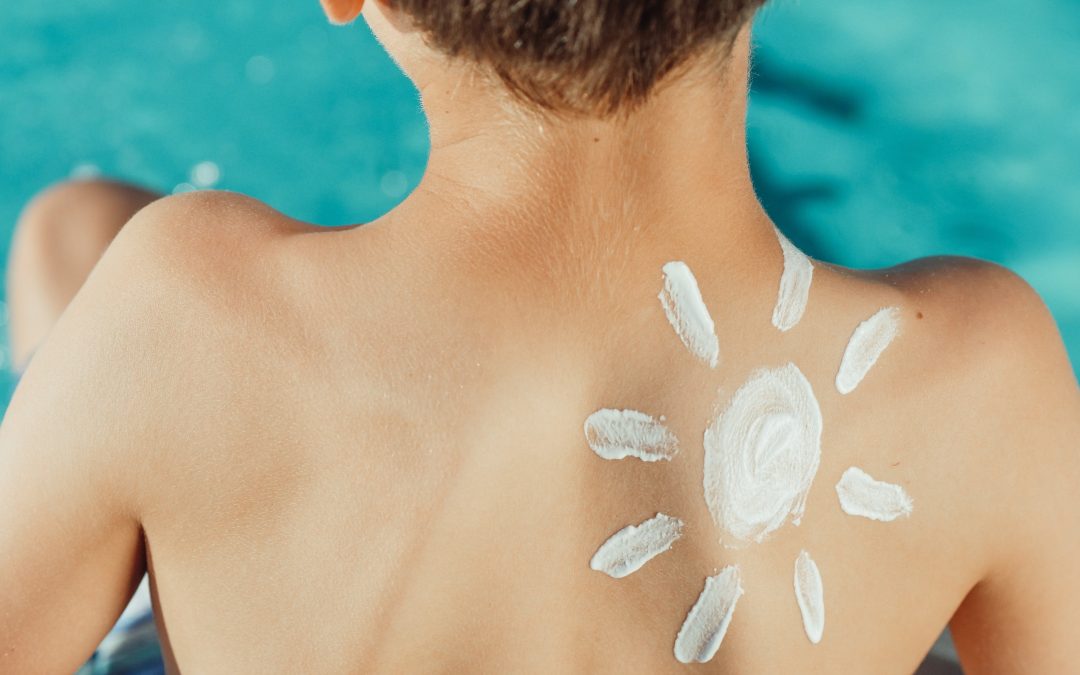 This is a photo of the upper back of child about 6 years old with a sun-shaped pattern made from sunscreen lotion on upper right shoulder. The image is meant to convey a need to protect the skin from adverse sun exposure which can damage the skin.